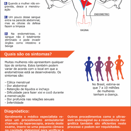 Descoberto Método para Prever Doença que Causa Infertilidade