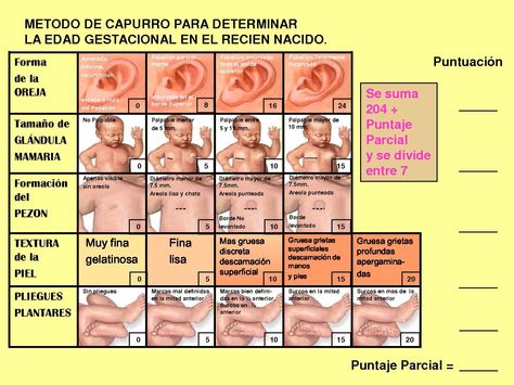 Preview Descoberto método para prever infarto e AVC com 10 anos de antecedência