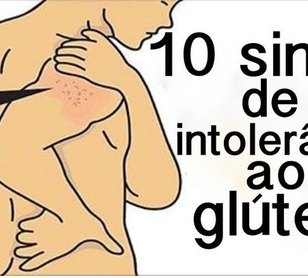 Mitos sobre a Sensibilidade ao Glúten em Pacientes com SII Desmistificados