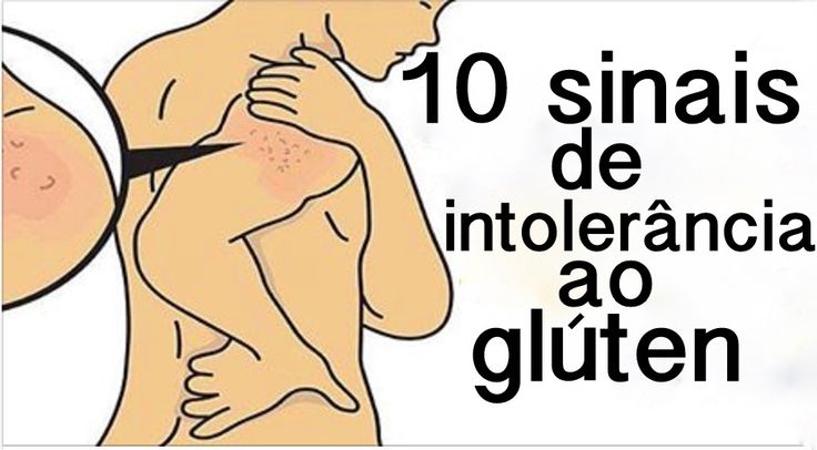 Preview Mitos sobre a Sensibilidade ao Glúten em Pacientes com SII Desmistificados