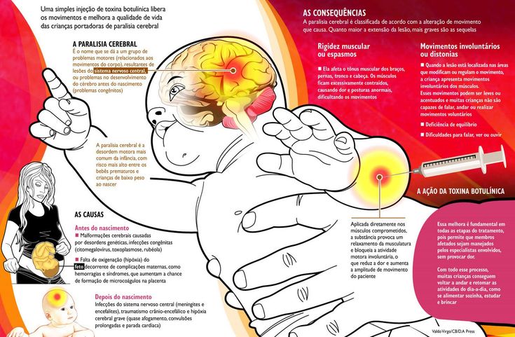 Preview Novas Pesquisas Revelam Potenciais Riscos do Eritritol para a Saúde Cerebral