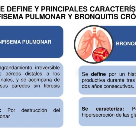 Cientistas Desenvolvem Teste Rápido para Detecção de Doença Pulmonar Crônica
