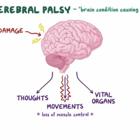 Consequência Inesperada da Pandemia: Aceleração do Envelhecimento Cerebral