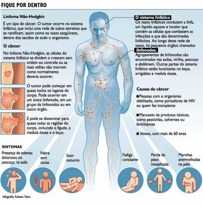 Preview Estudo Revela as Principais Causas do Câncer de Fígado