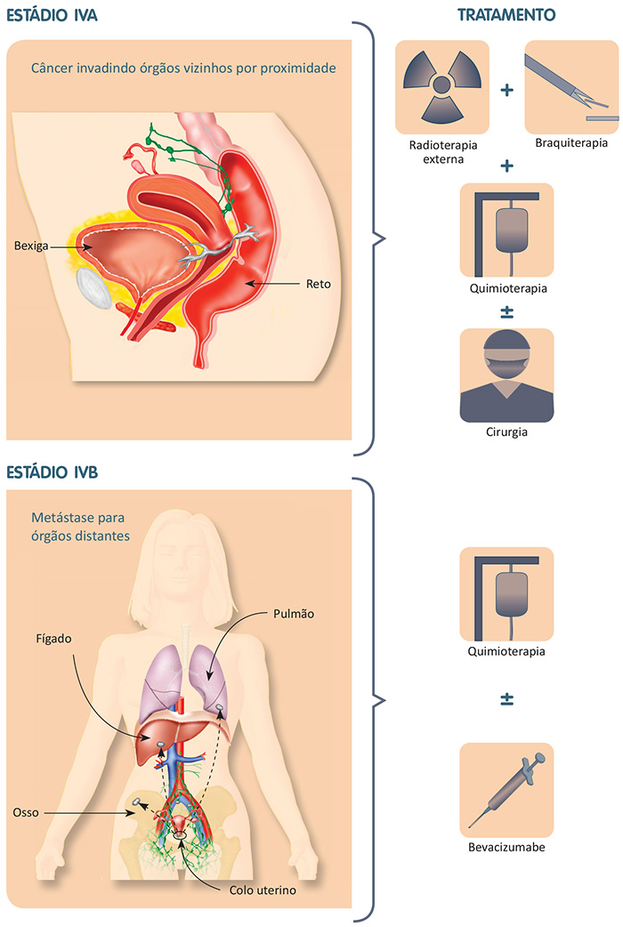 Preview Avanço Revolucionário na Terapia Alvo do Câncer e Infecções Virais