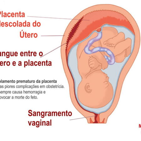 Descoberto um Modo Simples de Reduzir o Risco de Morte Prematura