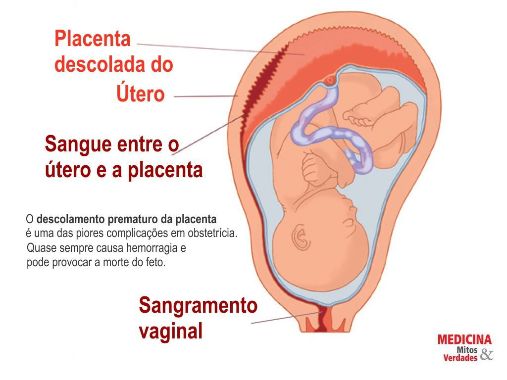 Preview Descoberto um Modo Simples de Reduzir o Risco de Morte Prematura