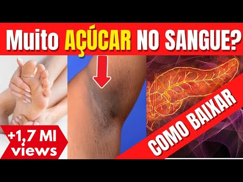 Preview Descoberta Promissora no Combate ao Cancro do Sangue Agressivo