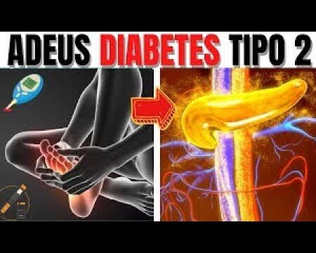 O Perigo da Batata Frita: Estudo Liga Consumo Frequente ao Diabetes Tipo 2