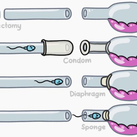 Efeito Inesperado de Pílulas Contraceptivas no Cérebro: Mudanças de Humor e Redes Neurais