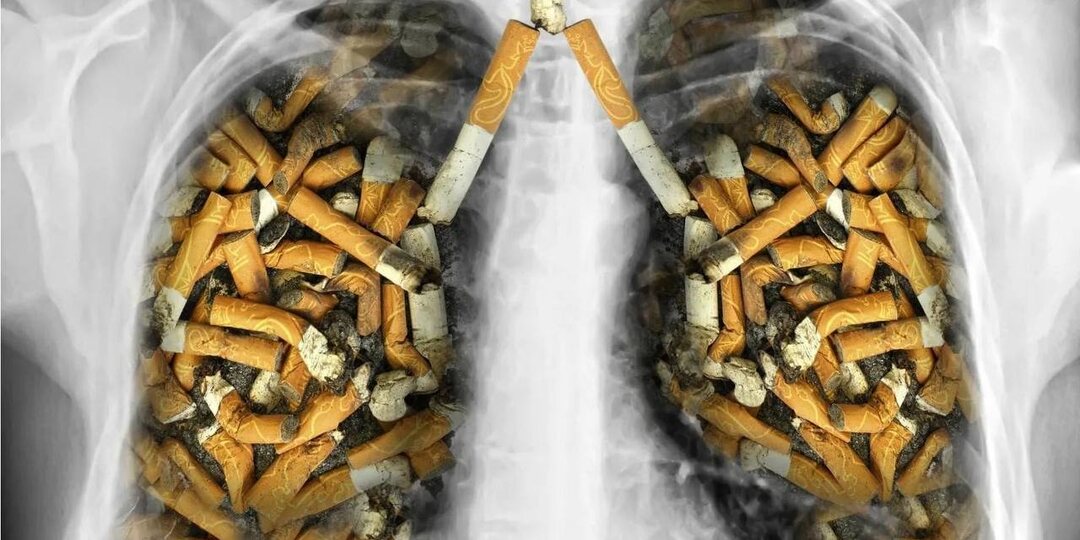 Preview O Prejuízo Inesperado dos Filtros de Cigarro: Uma Falsa Proteção e Real Ameaça Ecológica