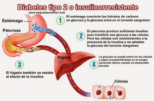Preview Diabetes Tipo 2: Uma Nova Ameaça ao Coração