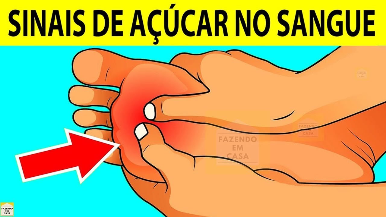 Preview Sinais Precursores de Parada Cardíaca Súbita Identificados