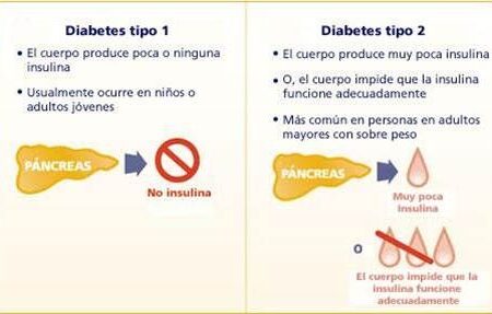 Método Inovador para o Tratamento do Diabetes Tipo 1: Produção de Insulina sem Imunossupressão