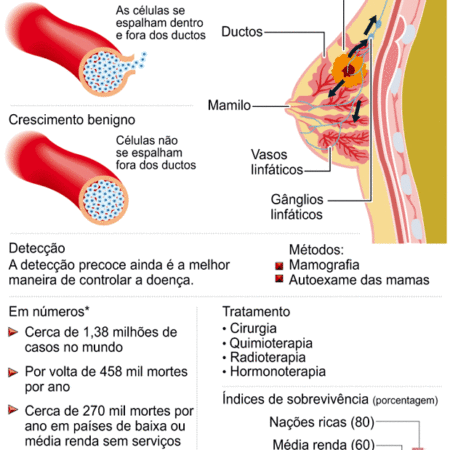 Método Inovador para Detecção Precoce de um Tipo Comum de Câncer