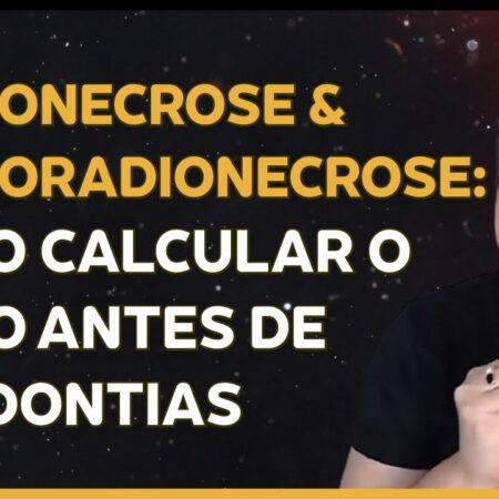 A Perigosa Consequência da COVID-19: Osteonecrose