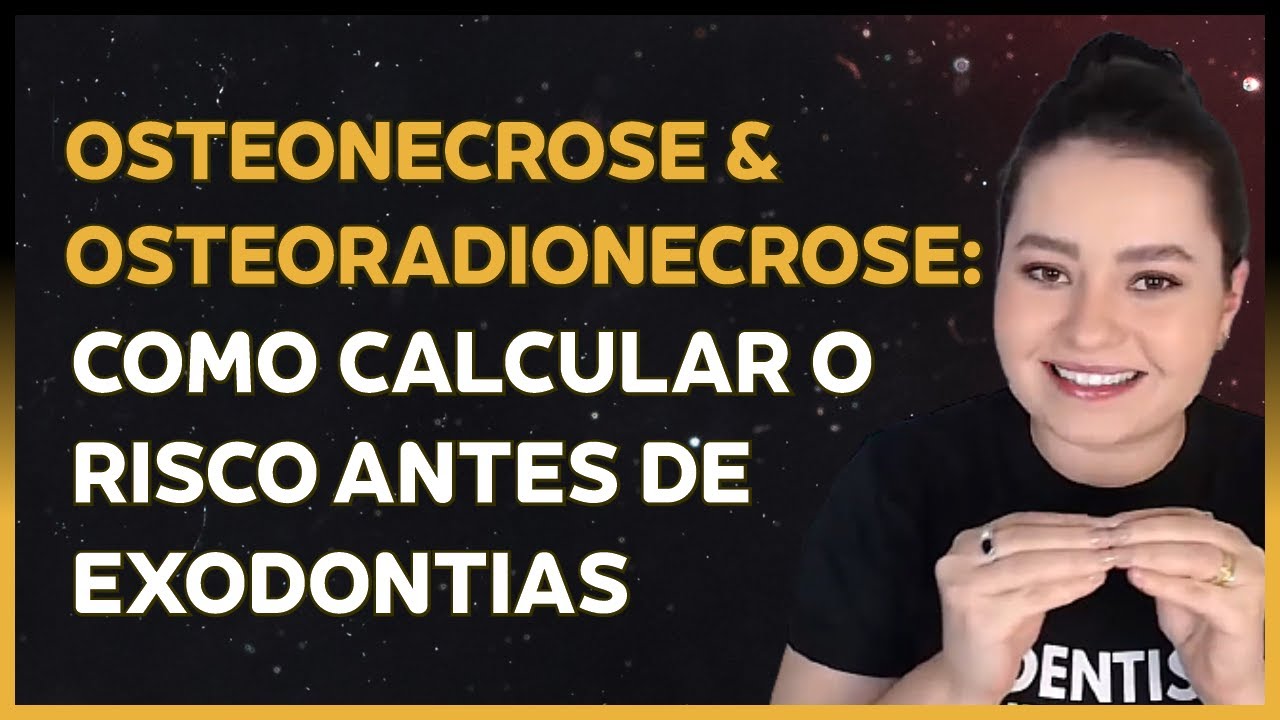 Preview A Perigosa Consequência da COVID-19: Osteonecrose