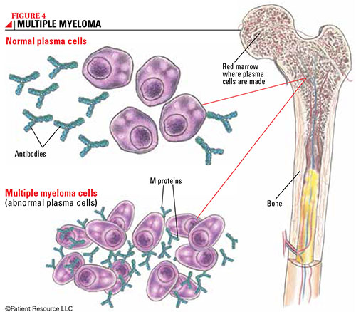 Preview Nova Abordagem para o Tratamento do Mieloma Múltiplo: Bloqueio da Enzima STK17B Induz a Morte de Células Cancerígenas