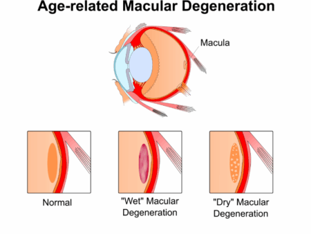 Descoberta: Como Reverter a Degeneração Visual Relacionada à Idade