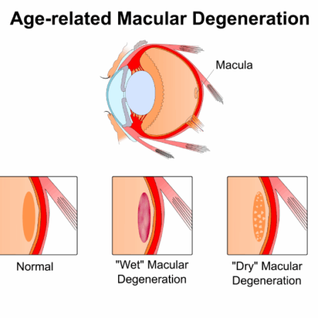 Descoberta: Como Reverter a Degeneração Visual Relacionada à Idade