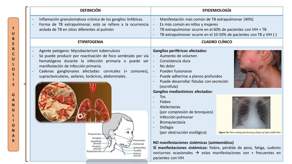 Preview Diagnóstico Instantâneo de Tuberculose pela Respiração: Uma Descoberta Científica