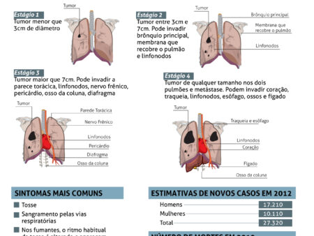 Descoberto Novo Método para Identificar Risco de Câncer de Pulmão em Não Fumantes