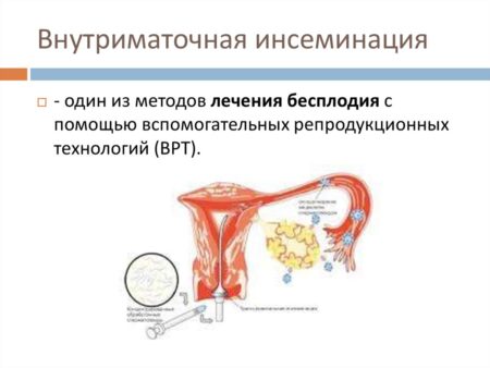 Совершен прорыв в лечении бесплодия с помощью мРНК-технологии