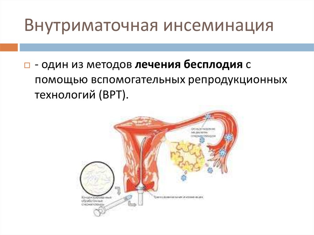 Preview Совершен прорыв в лечении бесплодия с помощью мРНК-технологии